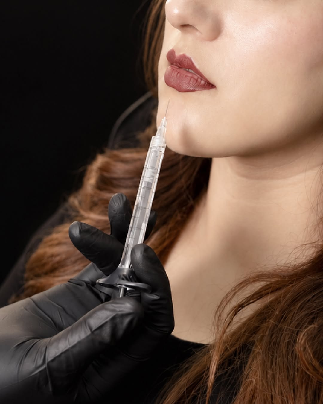 Médico aplicando relleno en los labios de una paciente