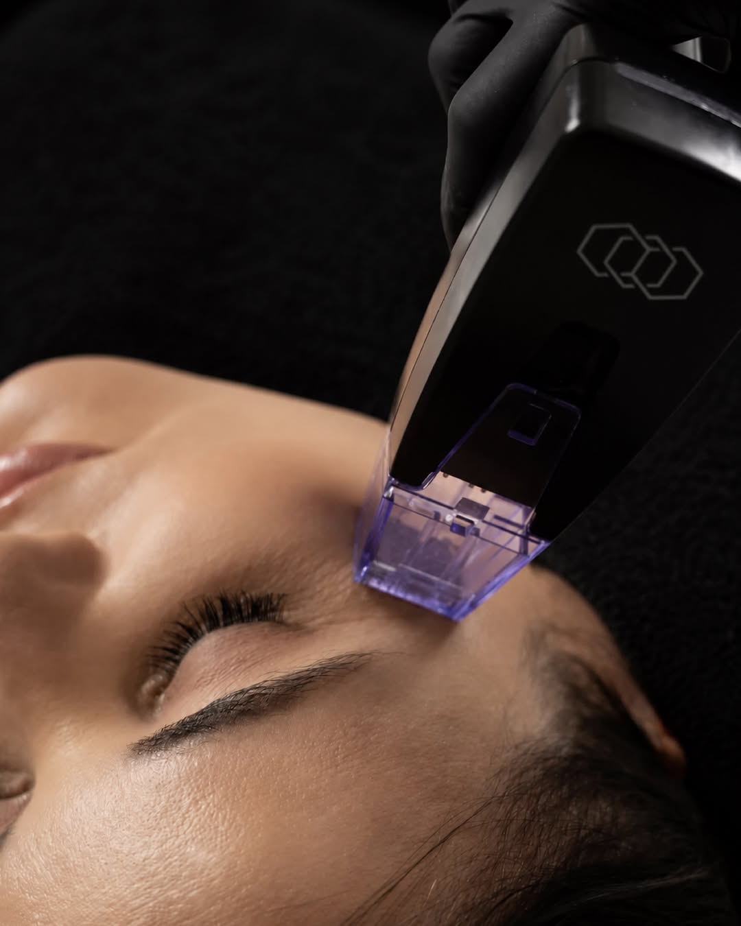 Tratamiento facial con un equipo de tecnología